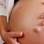 7 Cara Efektif Mengatasi Nyeri Panggul Pasca Melahirkan yang Harus Anda Coba!